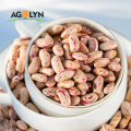 AGOLYN High Protein Light Speckled Flower Kidney Beans
